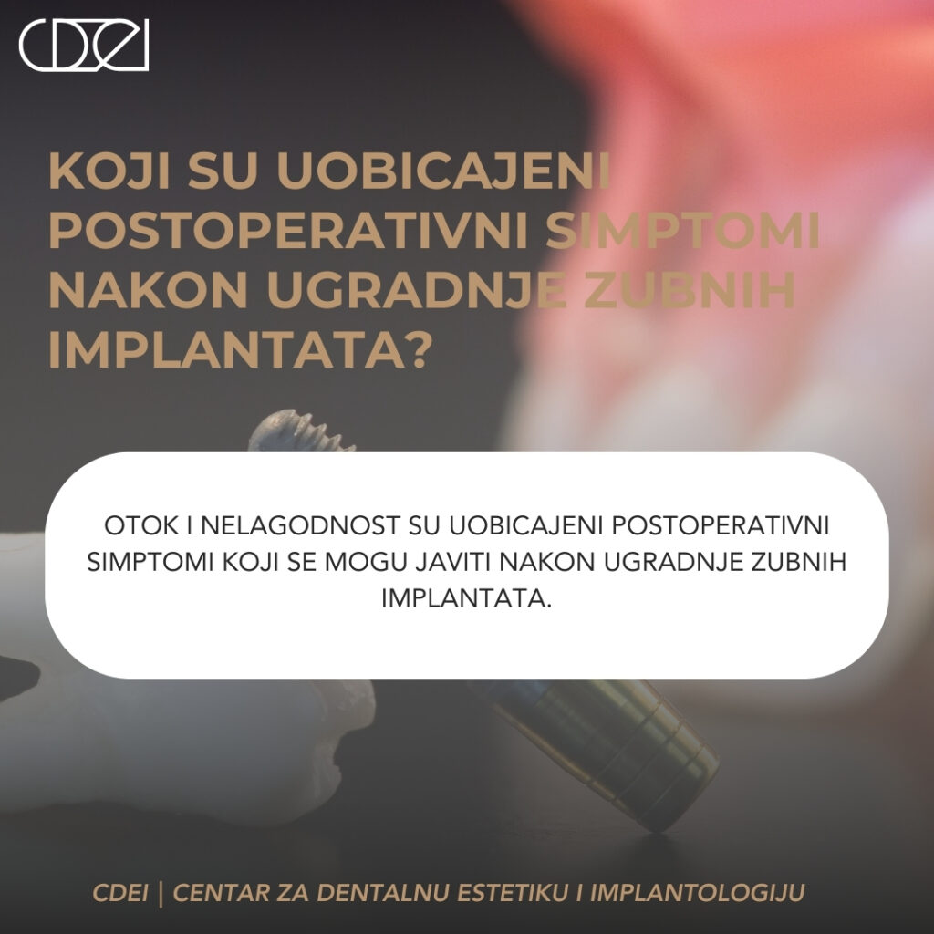 Otok i nelagodnost su uobicajeni postoperativni simptomi koji se mogu javiti nakon ugradnje zubnih implantata.