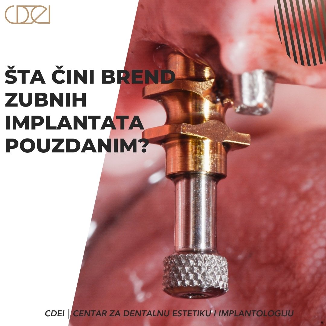 Šta čini brend zubnih implantata pouzdanim?
