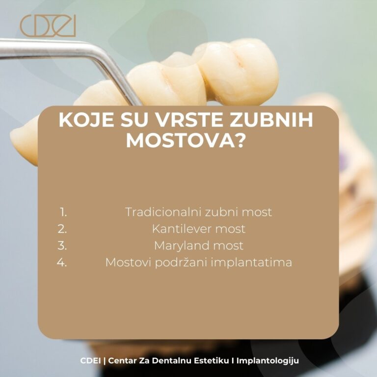 Vrste zubnih mostova prema materijalu, položaju i broju zuba