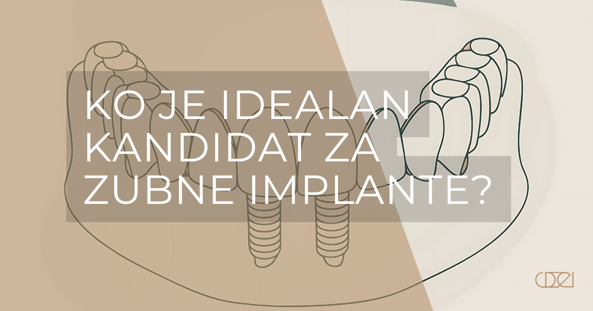 Ilustracija zubnih implanata sa pitanjem "Ko je idealan kandidat za zubne implante?" ispisanim preko slike.
