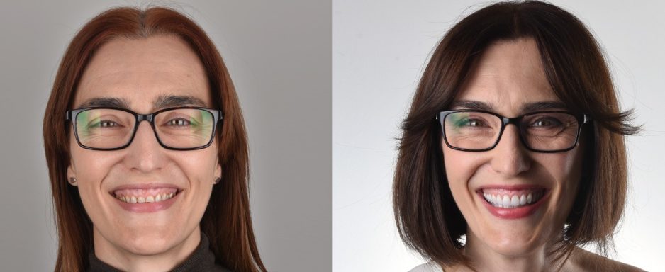 before-and-after_aleksandra7