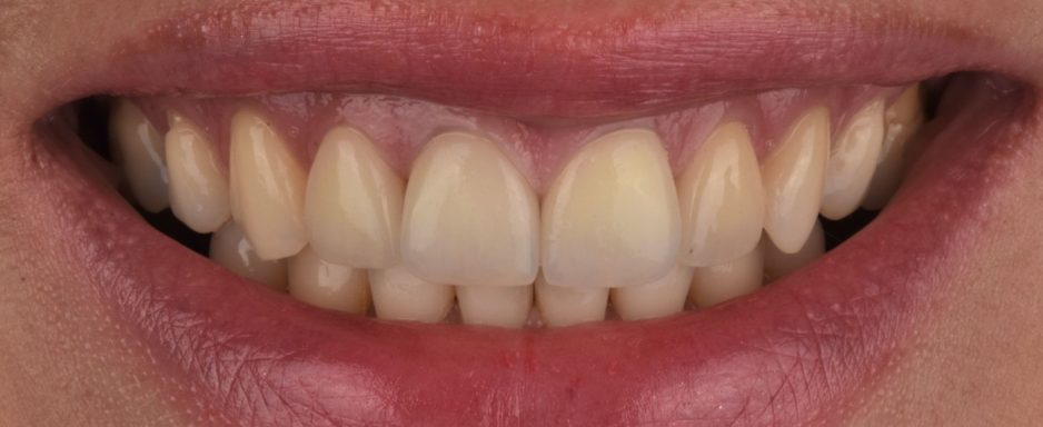 case-study-detail_2_milica