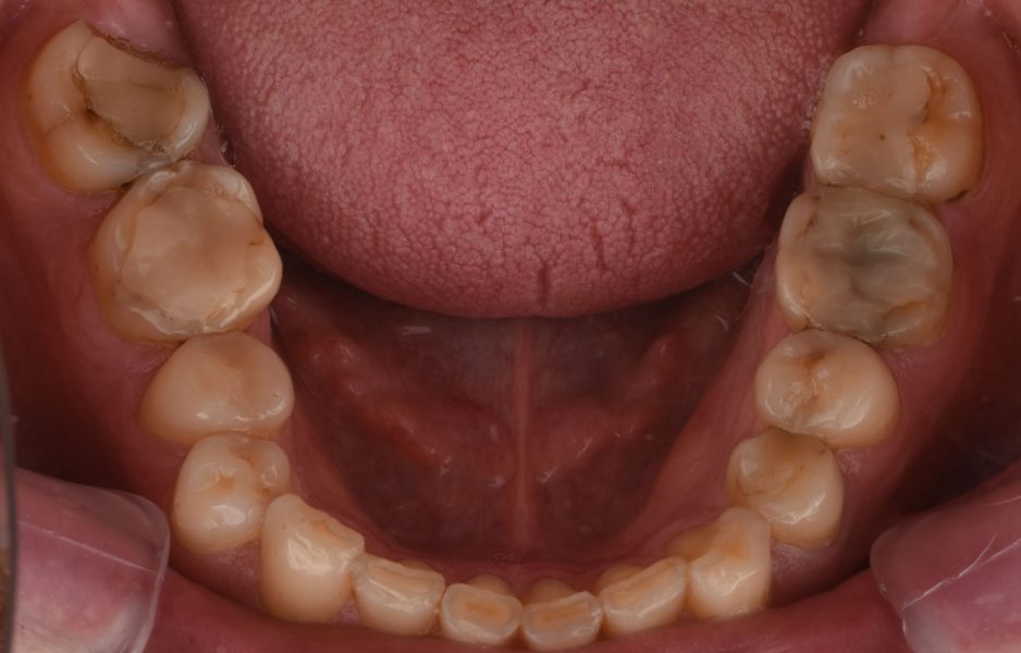 case_study_detail_veliko_pedja-3