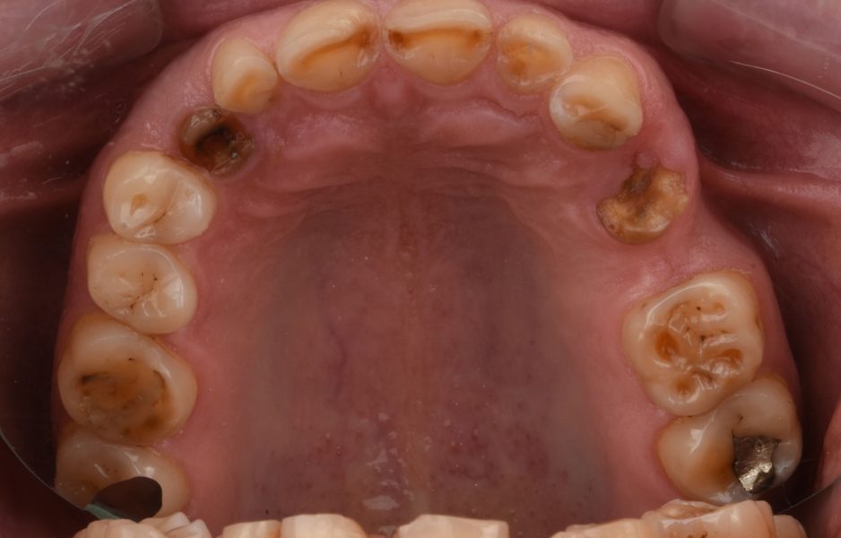 case_study_detaIL_pedja2
