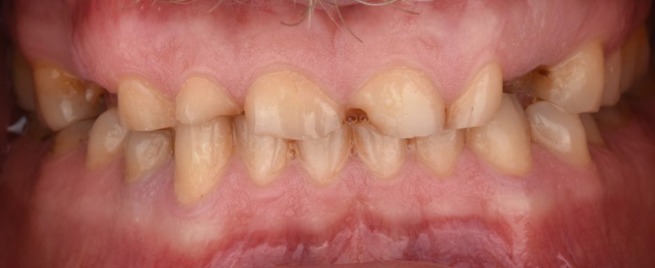detail_small_pedja1